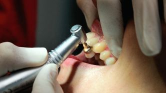 Santé : un nouveau traitement pour faire repousser les dents ?
