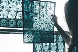 Peut-on mourir de la maladie d'Alzheimer ?