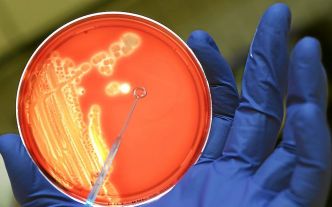 Intoxications alimentaires dans l'Aisne : les contaminations dues à la bactérie Escherichia coli