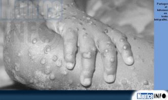 Multi-country outbreak of mpox, External situation report #54