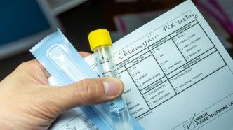 Face à la hausse des infections sexuelles, un kit de dépistage gratuit pour les 18-25 ans