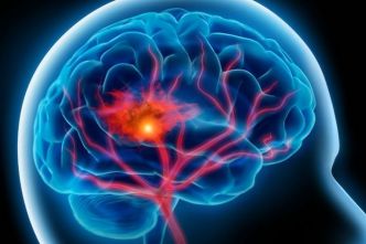 Maladies cardio-neuro-vasculaires : les habitants de l'Est de La Réunion, population la plus exposée