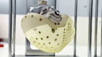 Carmat, le fabricant français d'un cœur artificiel temporaire, se déclare en cessation de paiements