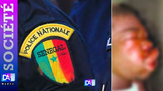 ROSSO – Supplice au commissariat : Talla Keita, 18 ans, battu, brisé... puis emporté par une septicémie...le procureur ordonne une enquête judiciaire complète et une autopsie
