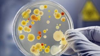 Intoxication à E. coli dans l'Aisne : confirmation d'un lien avec plusieurs boucheries
