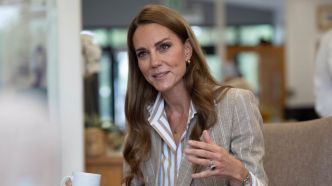 Kate Middleton méconnaissable, le visage tuméfié : elle apparait le visage couvert d'hématomes
