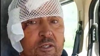 Turquie: un lion en fuite attaque un ouvrier agricole avant d'être abattu