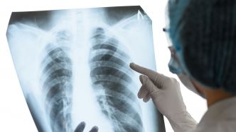 Actualité : Ce capteur à 50 centimes détecte le cancer ou le VIH depuis chez vous en auto-test
