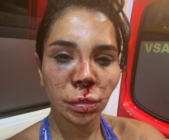 «Nous suspectons malheureusement qu'elle ait subi un viol» : une influenceuse victime d'un home-jacking à Marseille