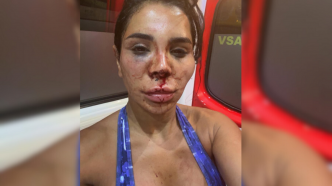« Ils ont cherché à me défigurer » : victime d'un home-jacking ultra-violent, l'influenceuse Soraya témoigne