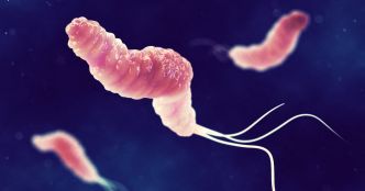 Cancer de l'estomac : comment se débarrasser de H. pylori, la bactérie responsable de 75 % des cas ?