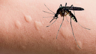Pourquoi les moustiques vous préfèrent-ils ?