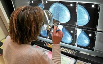 Mortalité historiquement basse en France en 2023 : les cancers et les maladies circulatoires restent les causes principales des décès