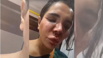 "J'ai été une boucherie pendant une heure et demi" : l'influenceuse Soraya Riffy sort du silence après un home-jacking d'une violence inouïe