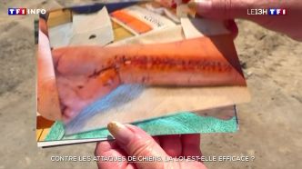 "Un film d'horreur" : victime d'une attaque de chiens errants, elle raconte son calvaire | TF1 INFO