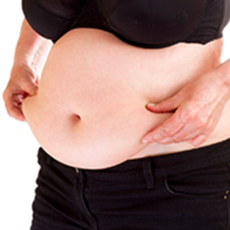 Grande Abdominoplastie Tunisie - clinique Pasteur