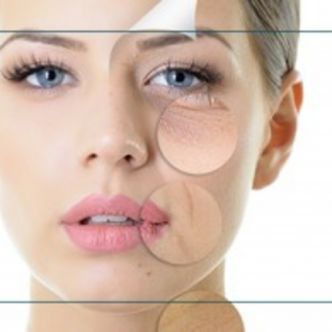 génioplastie tunisie - chirurgie esthétique tunisie
