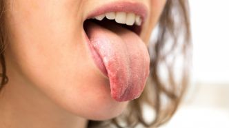 Ce que la couleur de votre langue révèle sur votre santé