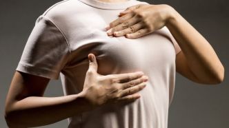 Atteinte d'un cancer, une femme reçoit 20 séances de radiothérapie sur le mauvais sein
