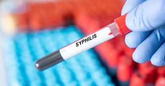 Syphilis : des symptômes inquiétants accompagnent la hausse des cas aux Etats-Unis