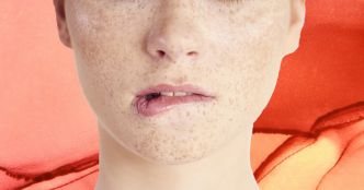 Se mordre les lèvres, une mauvaise habitude qui abîme durablement la peau