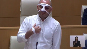 VIDEO. Echauffourées au Parlement géorgien : un député de l'opposition apparaît le visage tuméfié alors que le pays de déchire sur une loi sur les "agents étrangers"