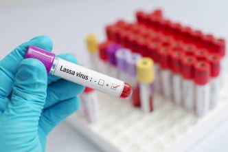Qu'est-ce que la fièvre de Lassa dont un cas a été confirmé en France ?