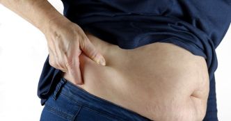 Comment enlever la graisse sans liposuccion ?