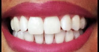 Dents blanches: Voici comment fabriquer son dentifrice bio en 1 min ! Sans FLUOR, sans produits CHIMIQUES