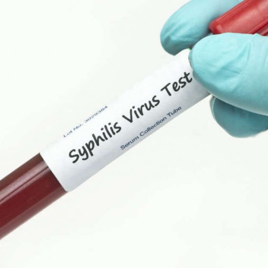 La recrudescence des cas de syphilis s'accompagne de symptômes inhabituels