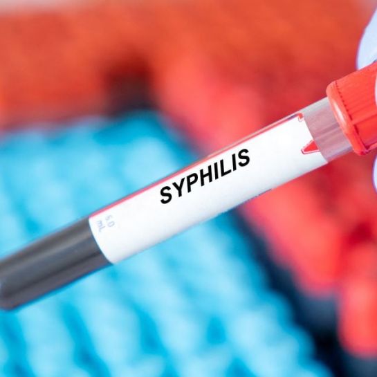 Syphilis : des symptômes inquiétants accompagnent la hausse des cas aux Etats-Unis